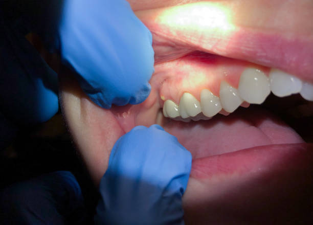 Best Walk-In Emergency Dental Services in Goldstream, AK